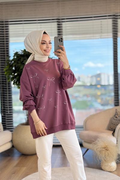 5753 Serpme Fiyonk Taş Baskılı Tunik Gül